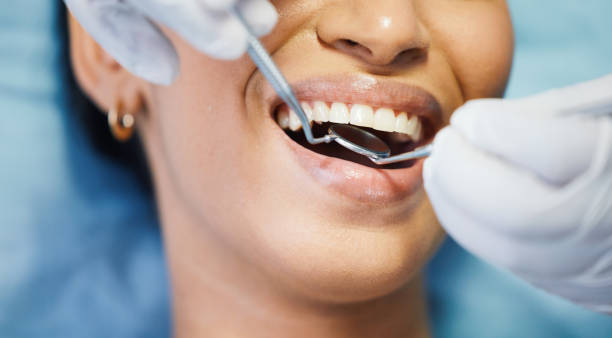 Best Emergency Dentist for Lost Fillings or Crowns in Elkridge, MD